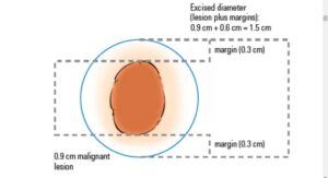 What is the Margin?