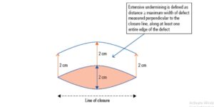 Coding guidelines for skin laceration repair