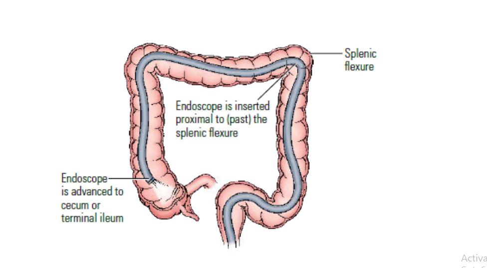 CPT coding guidelines for colonoscopy procedure