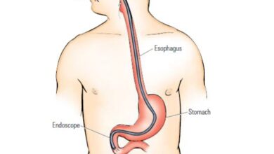 Coding guidelines for Endoscopy